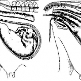 Krvavi iscjedak iz krave: od trudnice, nakon teljenja